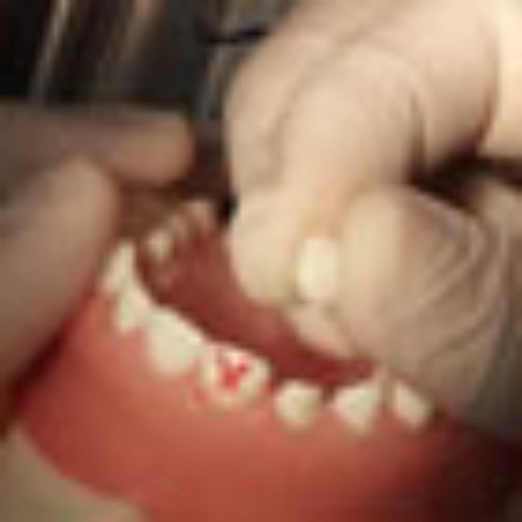 Dra. Gisela Bona realizó workshop de coronas de zirconio para diente primarios