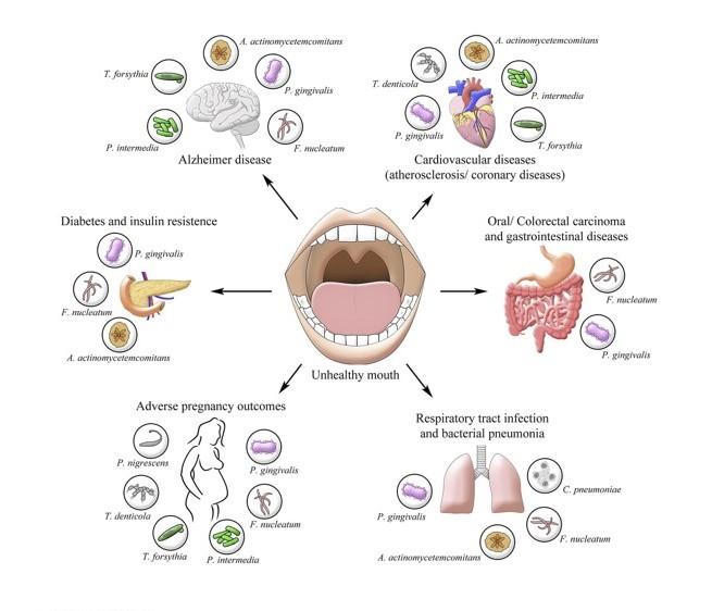 18 NOVIEMBRE 2024 / Curso Atención Periodontal en la Estrategia de Cuidado Integral Centrado en las Personas con Diabetes