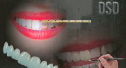 MARZO / Curso Diseño Digital de Sonrisa: una potente herramienta diagnóstico-terapéutica
